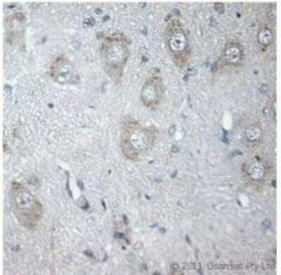 Immunohistochemistry-Paraffin: Vanilloid R1/TRPV1 Antibody [NB100-98897]