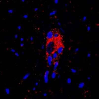 Immunohistochemistry-Paraffin: Vanilloid R1/TRPV1 Antibody - BSA Free [NBP1-71774]