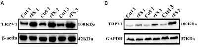 Western Blot: Vanilloid R1/TRPV1 Antibody [NB100-98886]