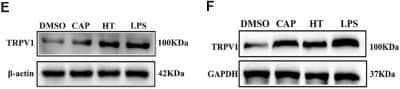 Western Blot: Vanilloid R1/TRPV1 Antibody [NB100-98886]