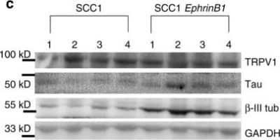 Western Blot: Vanilloid R1/TRPV1 Antibody [NB100-98897]