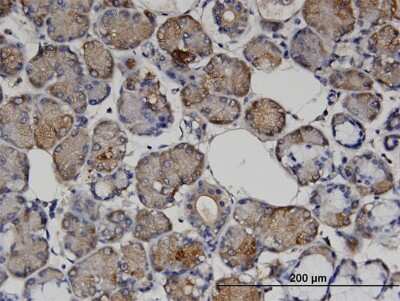 Immunohistochemistry-Paraffin: Vasohibin Antibody (4A3) [H00022846-M05]
