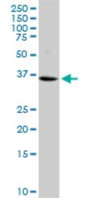 Western Blot: Vasohibin Antibody (4A3) [H00022846-M05]