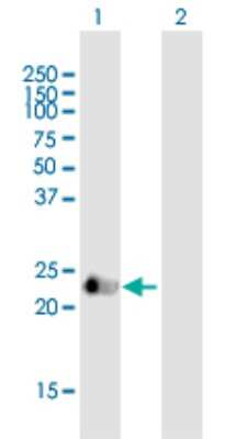 Western Blot: Vasohibin Antibody [H00022846-B01P]