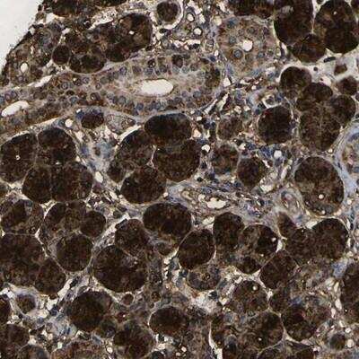 Immunohistochemistry-Paraffin: Vasorin/SLIT-like 2 Antibody [NBP1-80741]