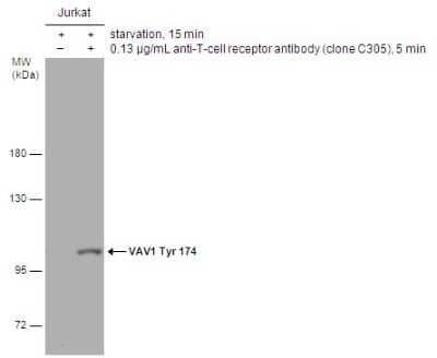 Western Blot: Vav-1 [p Tyr174] Antibody [NBP3-13140]