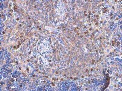 Immunohistochemistry-Paraffin: Vav-1 Antibody (557) [NBP2-43553]