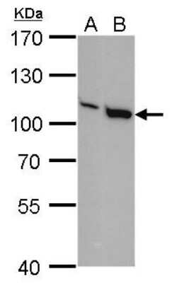 Western Blot: Vav-1 Antibody (557) [NBP2-43553]