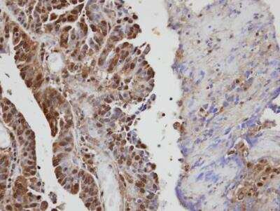 Immunohistochemistry-Paraffin: Vav-1 Antibody [NBP1-31426]