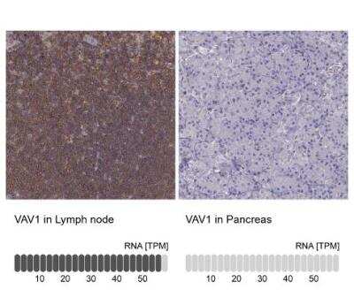 Immunohistochemistry-Paraffin: Vav-1 Antibody [NBP1-86867]