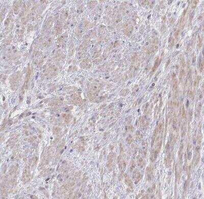 Immunohistochemistry-Paraffin: Vav-1 Antibody [NBP1-86867]
