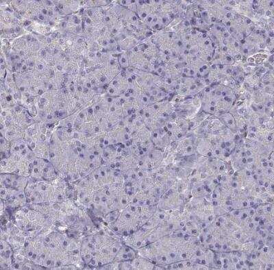 Immunohistochemistry-Paraffin: Vav-1 Antibody [NBP1-86867]
