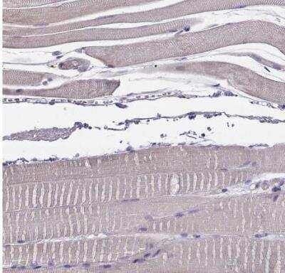 Immunohistochemistry-Paraffin: Vav-1 Antibody [NBP1-86867]
