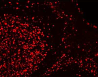 Immunofluorescence: VectaFluor(TM) Excel Amp. anti-Rabbit IgG DL594 Ab Kit [DK-1594-NB]