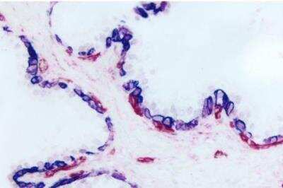 Immunohistochemistry: VECTASTAIN(R) ABC anti-Mouse IgG AP Immunodetection Kit [AK-5002-NB]