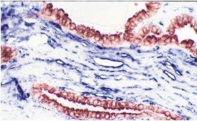 Immunohistochemistry: VECTASTAIN(R) ABC anti-Mouse IgG AP Immunodetection Kit [AK-5002-NB]