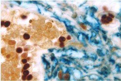 Immunohistochemistry: VECTASTAIN(R) ABC anti-Mouse IgG AP Immunodetection Kit [AK-5002-NB]