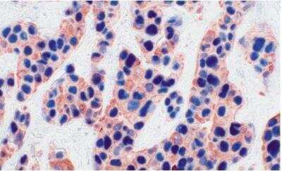 Immunohistochemistry: VECTASTAIN(R) ABC anti-Mouse IgG AP Immunodetection Kit [AK-5002-NB]