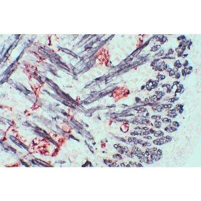 Immunohistochemistry: M.O.M.(R) (Mouse-On-Mouse) Elite(R) IgG HRP Immunodetection Kit [PK-2200-NB]