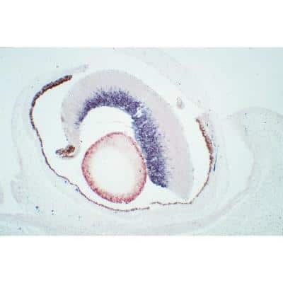 Immunohistochemistry: M.O.M.(R) (Mouse-On-Mouse) Elite(R) IgG HRP Immunodetection Kit [PK-2200-NB]