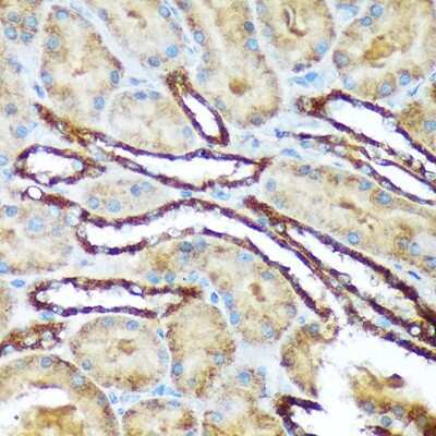 Immunohistochemistry-Paraffin: Versican Antibody (6D8K9) [NBP3-15841]