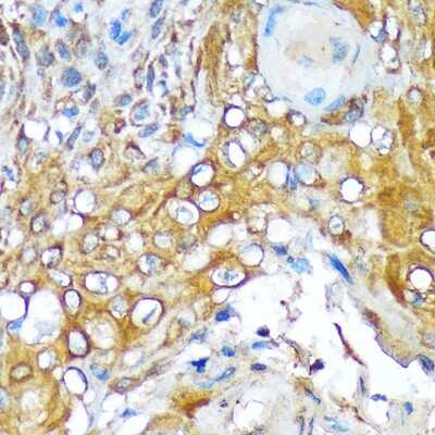 Immunohistochemistry-Paraffin: Versican Antibody (6D8K9) [NBP3-15841]