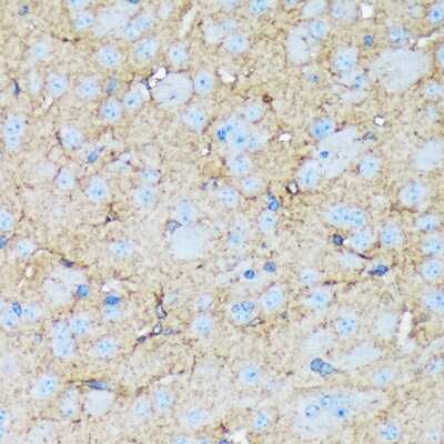 Immunohistochemistry-Paraffin: Versican Antibody (6D8K9) [NBP3-15841]