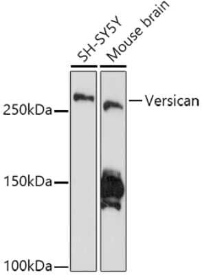 Western Blot: Versican Antibody (6D8K9) [NBP3-15841]