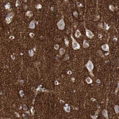 Immunohistochemistry-Paraffin: Versican Antibody [NBP1-85432]