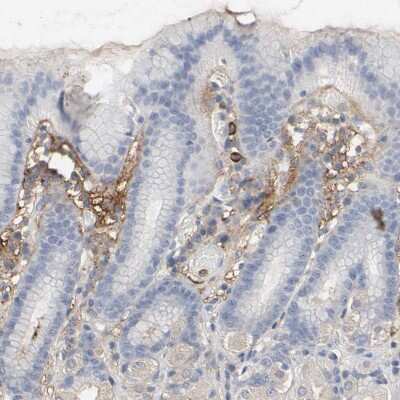 Immunohistochemistry-Paraffin: Versican Antibody [NBP1-85432]