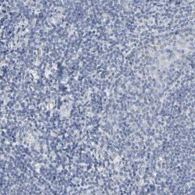 Immunohistochemistry-Paraffin: Versican Antibody [NBP1-85432]