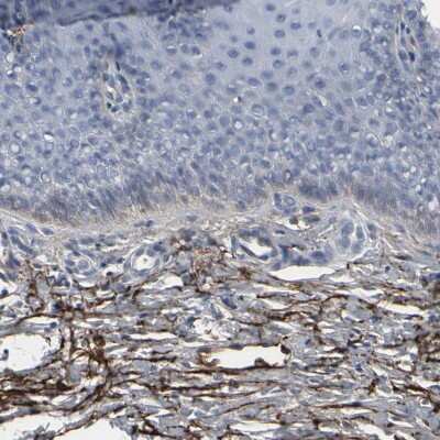 Immunohistochemistry-Paraffin: Versican Antibody [NBP1-85432]