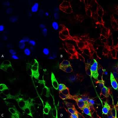 Immunocytochemistry/ Immunofluorescence: Versican Antibody (S351-23) [NBP2-22408]