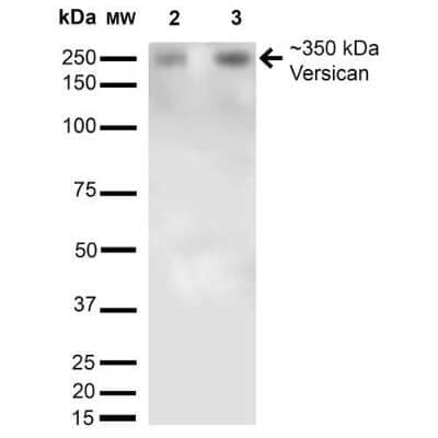 Western Blot: Versican Antibody (S351-23) [NBP2-22408]