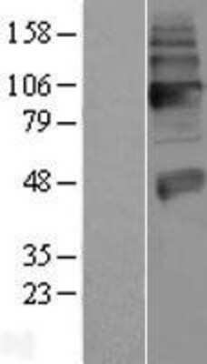 Western Blot: VAChT/SLC18A3 Overexpression Lysate [NBP2-10859]