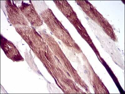 Immunohistochemistry-Paraffin: Villin 1 Antibody (5E3B2) - BSA Free [NBP2-52584]