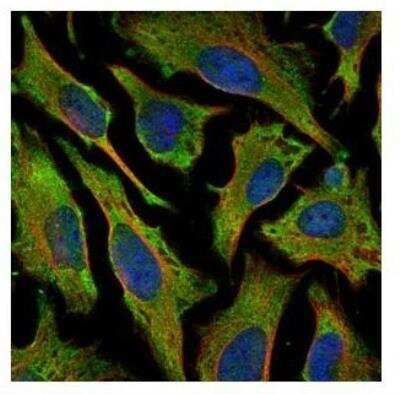 Immunocytochemistry/ Immunofluorescence: Villin 1 Antibody [NBP1-32841]