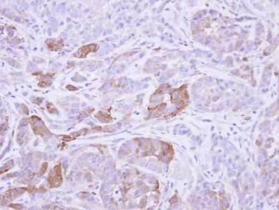 Immunohistochemistry-Paraffin: Villin 1 Antibody [NBP1-32841]