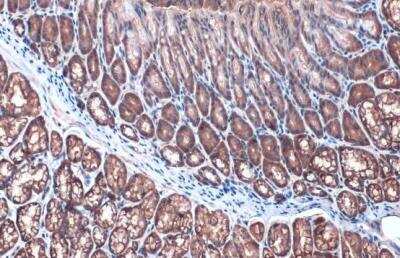 Immunohistochemistry-Paraffin: Villin 1 Antibody [NBP1-32841]