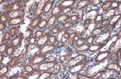 Immunohistochemistry-Paraffin: Villin 1 Antibody [NBP1-32841]
