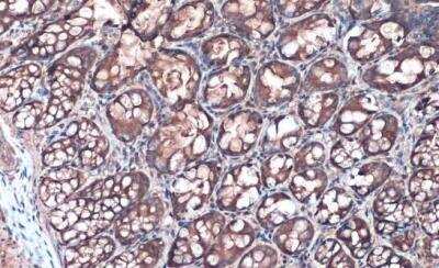 Immunohistochemistry-Paraffin: Villin 1 Antibody [NBP1-32841]