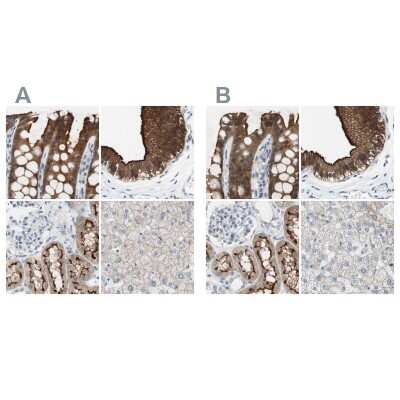 Immunohistochemistry-Paraffin: Villin 1 Antibody [NBP1-85335]