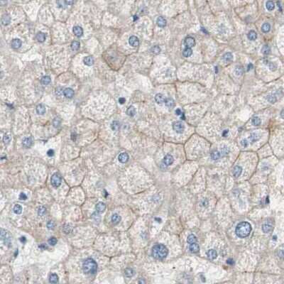 Immunohistochemistry-Paraffin: Villin 1 Antibody [NBP1-85335]