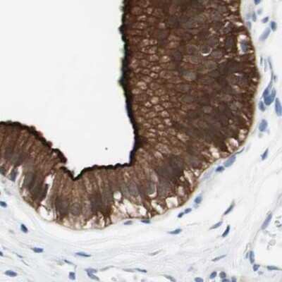Immunohistochemistry-Paraffin: Villin 1 Antibody [NBP1-85335]