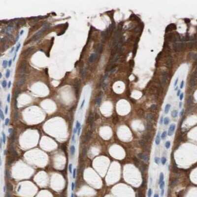 Immunohistochemistry-Paraffin: Villin 1 Antibody [NBP1-85335]