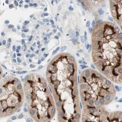 Immunohistochemistry-Paraffin: Villin 1 Antibody [NBP1-85335]
