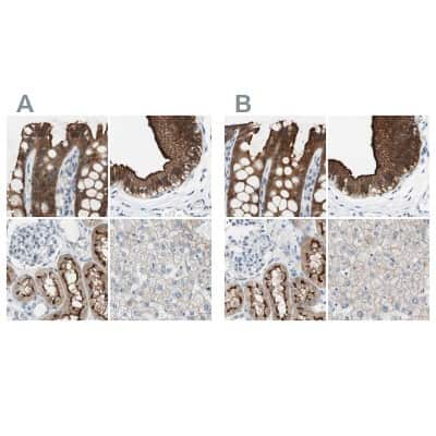 Immunohistochemistry-Paraffin: Villin 1 Antibody [NBP1-85336]