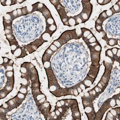 Immunohistochemistry-Paraffin: Villin 1 Antibody [NBP1-85336]