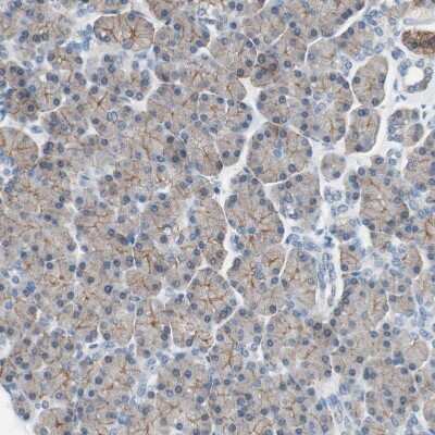 Immunohistochemistry-Paraffin: Villin 1 Antibody [NBP1-85336]
