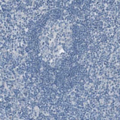 Immunohistochemistry-Paraffin: Villin 1 Antibody [NBP1-85336]